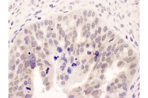 Immunohistochemistry (IHC) image for anti-N-Myc (And STAT) Interactor (NMI) (AA 1-50) antibody (ABIN7454367)