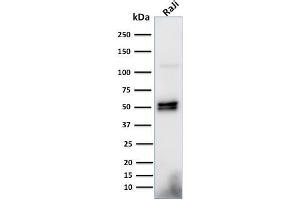 Western Blot Analysis of Raji cell lysate using CD79a Monoclonal Antibody (HM57). (CD79a Antikörper  (AA 202-216))