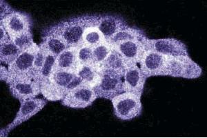 Immunofluorescence staining on A431 cells (Human epithelial carcinoma, ATCC CRL-1555). (Density Regulated Protein Antikörper  (AA 19-201))