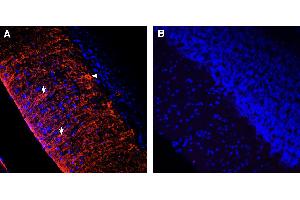 Comparison of immunostaining with Anti-KV1. (Kaninchen IgG isotype control (Atto 550))