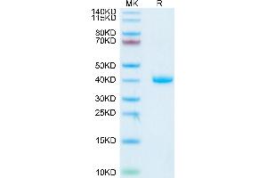 RSPO1 Protein (His tag)