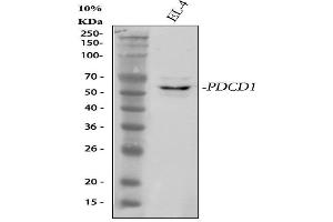 Western blot analysis of PDCD1 using anti-PDCD1 antibody (ABIN5518784). (PD-1 Antikörper  (N-Term))