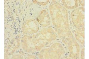 Immunohistochemistry of paraffin-embedded human kidney tissue using ABIN7158162 at dilution of 1:100 (LRRC31 Antikörper  (AA 1-300))