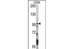 Western blot analysis of hHDAC7- (ABIN387957 and ABIN2844663) in CEM cell line lysates (35 μg/lane). (HDAC7 Antikörper  (C-Term))