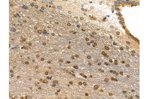Phospho-AIRE (Ser156) Antibody at 1/100 staining Rat brain tissue by IHC-P.