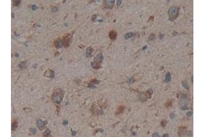 Detection of CNX in Human Glioma Tissue using Polyclonal Antibody to Calnexin (CNX)
