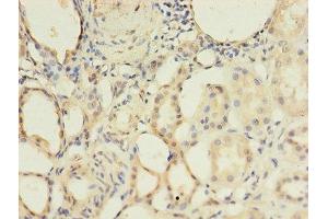 Immunohistochemistry of paraffin-embedded human kidney tissue using ABIN7145704 at dilution of 1:100 (BMPR1A Antikörper  (AA 177-532))