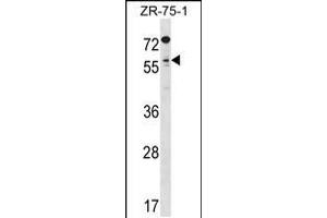 Western blot analysis in ZR-75-1 cell line lysates (35ug/lane). (TCFL5 Antikörper  (C-Term))