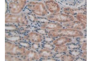 Detection of LPCAT3 in Human Kidney Tissue using Polyclonal Antibody to Lysophosphatidylcholine Acyltransferase 3 (LPCAT3) (LPCAT3 Antikörper  (AA 122-233))