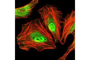 Immunofluorescence analysis of HeLa cells.