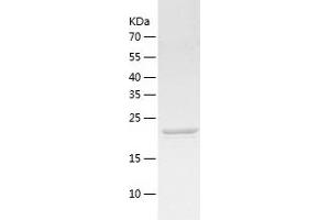 Western Blotting (WB) image for Ubiquitin Carboxyl-terminal Esterase L1 (Ubiquitin Thiolesterase) (UCHL1) (AA 1-223) protein (His tag) (ABIN7125580) (UCHL1 Protein (AA 1-223) (His tag))