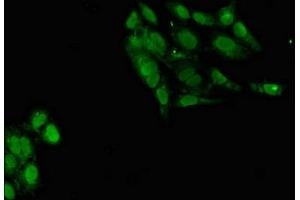 Immunofluorescent analysis of Hela cells using ABIN7164998 at dilution of 1:100 and Alexa Fluor 488-congugated AffiniPure Goat Anti-Rabbit IgG(H+L) (POT1 Antikörper  (AA 250-432))