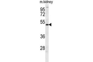 Western Blotting (WB) image for anti-Doublesex and Mab-3 Related Transcription Factor 3 (DMRT3) antibody (ABIN2995697) (DMRT3 Antikörper)