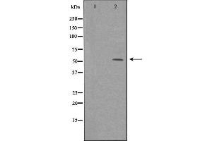 Western blot analysis of extracts from HeLa cells, using ME1 antibody. (ME1 Antikörper  (C-Term))