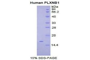SDS-PAGE (SDS) image for Plexin B1 (PLXNB1) (AA 47-126) protein (His tag) (ABIN1080549) (PLXNB1 Protein (AA 47-126) (His tag))