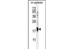 ZN Antibody (Center) (ABIN656018 and ABIN2845393) western blot analysis in mouse spleen tissue lysates (35 μg/lane). (ZNF593 Antikörper  (AA 62-88))