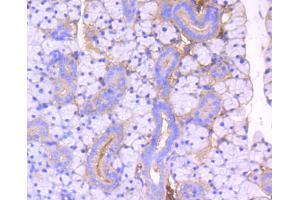 Immunohistochemistry (IHC) image for anti-rho-Associated, Coiled-Coil Containing Protein Kinase 1 (ROCK1) antibody (ABIN4905028)