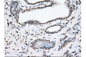 Immunohistochemical staining of paraffin-embedded Human liver tissue using anti-TACC3 mouse monoclonal antibody. (TACC3 Antikörper)