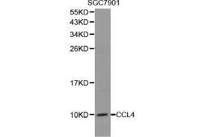 Western blot analysis of extracts of SGC7901 cell lines, using CCL4 antibody. (CCL4 Antikörper  (C-Term))