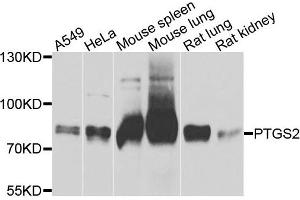 Western blot analysis of extracts of various cells, using PTGS2 antibody. (PTGS2 Antikörper)