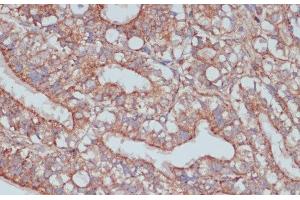 Immunohistochemistry of paraffin-embedded Rat ovary using MOB4 Polyclonal Antibody at dilution of 1:100 (40x lens).