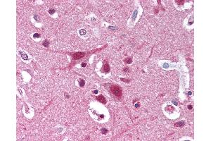 Anti-DDB1 antibody IHC of human brain, cortex.