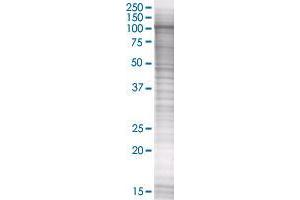 Western Blotting (WB) image for RAPGEF4 293T Cell Transient Overexpression Lysate(Denatured) (ABIN1335276)