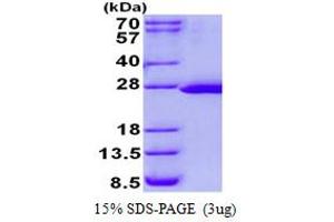 Image no. 1 for FtsJ RNA Methyltransferase Homolog 2 (FTSJ2) protein (His tag) (ABIN1098388) (FTSJ2 Protein (His tag))