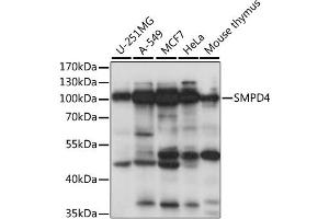 Western blot analysis of extracts of various cell lines, using SMPD4 antibody (ABIN6291650) at 1:1000 dilution. (SMPD4 Antikörper)