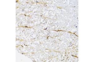 Immunohistochemistry of paraffin-embedded rat spinal cord using KIF1B Antibody (ABIN2563552) at dilution of 1:100 (40x lens). (KIF1B Antikörper)