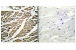 Immunohistochemistry (IHC) image for anti-Sodium Channel, Voltage-Gated, Type V, alpha Subunit (SCN5A) antibody (ABIN7182719)