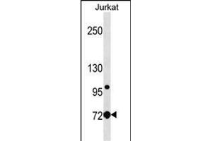 LCP1 Antibody (Center) (ABIN1538283 and ABIN2850258) western blot analysis in Jurkat cell line lysates (35 μg/lane). (LCP1 Antikörper  (AA 306-335))