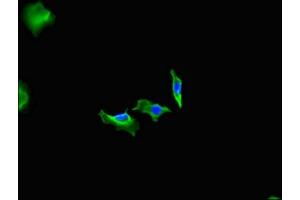 Immunofluorescent analysis of Hela cells using ABIN7152932 at dilution of 1:100 and Alexa Fluor 488-congugated AffiniPure Goat Anti-Rabbit IgG(H+L) (Fidgetin Antikörper  (AA 132-371))