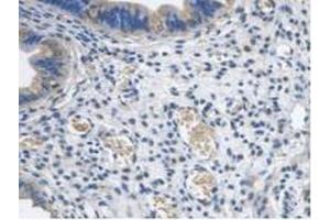 IHC-P analysis of Mouse Uterus Tissue, with DAB staining. (PCYOX1 Antikörper  (AA 249-505))