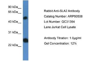 WB Suggested Anti-SLA2  Antibody Titration: 0. (SLAP2 Antikörper  (N-Term))