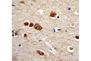 IHC analysis of FFPE human brain tissue stained with HuR antibody (ELAVL1 Antikörper)