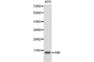 Western blot analysis of A375 cell lysate using S100B antibody. (S100B Antikörper  (AA 1-92))