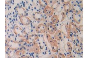 Immunohistochemistry (IHC) image for anti-Interleukin 11 Receptor, alpha (IL11RA) (AA 59-217) antibody (ABIN7437794)