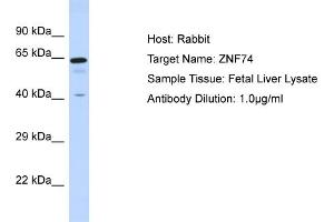 Host: Rabbit Target Name: ZNF74 Sample Tissue: Human Fetal Liver Antibody Dilution: 1ug/ml (ZNF74 Antikörper  (N-Term))
