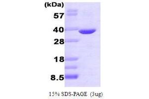 SDS-PAGE (SDS) image for Aldo-Keto Reductase Family 1, Member B1 (Aldose Reductase) (AKR1B1) (AA 1-316) (Active) protein (ABIN935005)
