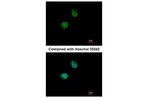 ICC/IF Image Immunofluorescence analysis of paraformaldehyde-fixed HeLa, using S6K2, antibody at 1:500 dilution. (RPS6KB2 Antikörper  (Center))