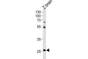 Western Blotting (WB) image for anti-Homeobox C4 (HOXC4) antibody (ABIN3004626) (HOXC4 Antikörper)