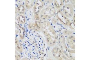 Immunohistochemistry of paraffin-embedded rat kidney using UBE3A antibody. (ube3a Antikörper  (AA 300-590))