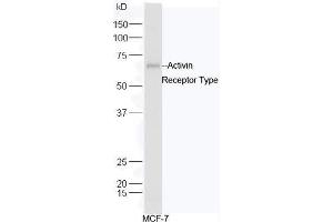 Human MCF-7 cell lysates probed with Rabbit Anti-ACVR2B/ACTR-IIB Polyclonal Antibody, Unconjugated  at 1:5000 for 90 min at 37˚C. (ACVR2B Antikörper  (AA 45-150))