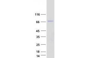 Validation with Western Blot (HEXB Protein (Myc-DYKDDDDK Tag))