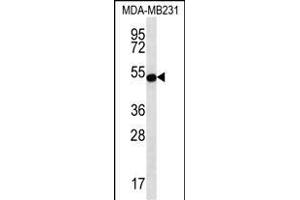 ST Antibody (Center) (ABIN656667 and ABIN2845907) western blot analysis in MDA-M cell line lysates (35 μg/lane). (STAP2 Antikörper  (AA 187-216))