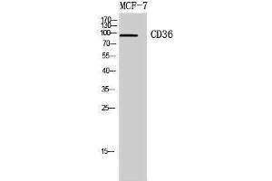 Western Blotting (WB) image for anti-CD36 (CD36) (Internal Region) antibody (ABIN3178931) (CD36 Antikörper  (Internal Region))