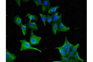 Immunofluorescence (IF) image for anti-Guanine Nucleotide Binding Protein (G Protein), alpha Transducing Activity Polypeptide 1 (GNAT1) (AA 92-170) antibody (ABIN7154711)