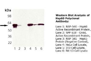 Western Blotting (WB) image for anti-Heat Shock 60kDa Protein 1 (Chaperonin) (HSPD1) antibody (ABIN615267) (HSPD1 Antikörper)