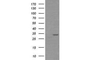 Image no. 3 for anti-Retinoic Acid Receptor Responder (Tazarotene Induced) 1 (RARRES1) antibody (ABIN1500604) (RARRES1 Antikörper)
